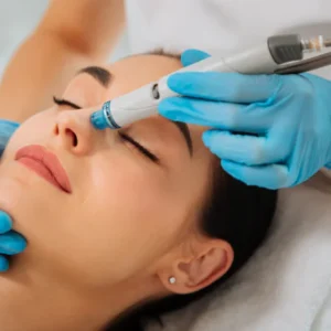 Tratamiento hidrofacial